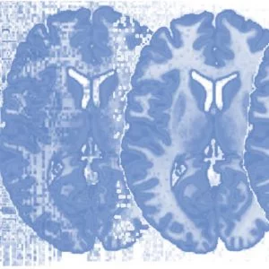 Principles of fMRI 1