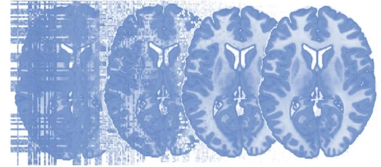 Principles of fMRI 1